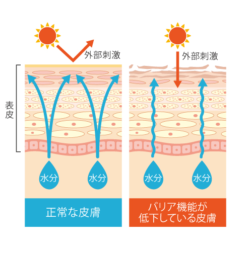 2020年皮ふの日通信７月号、肌ダメージとリポソーム