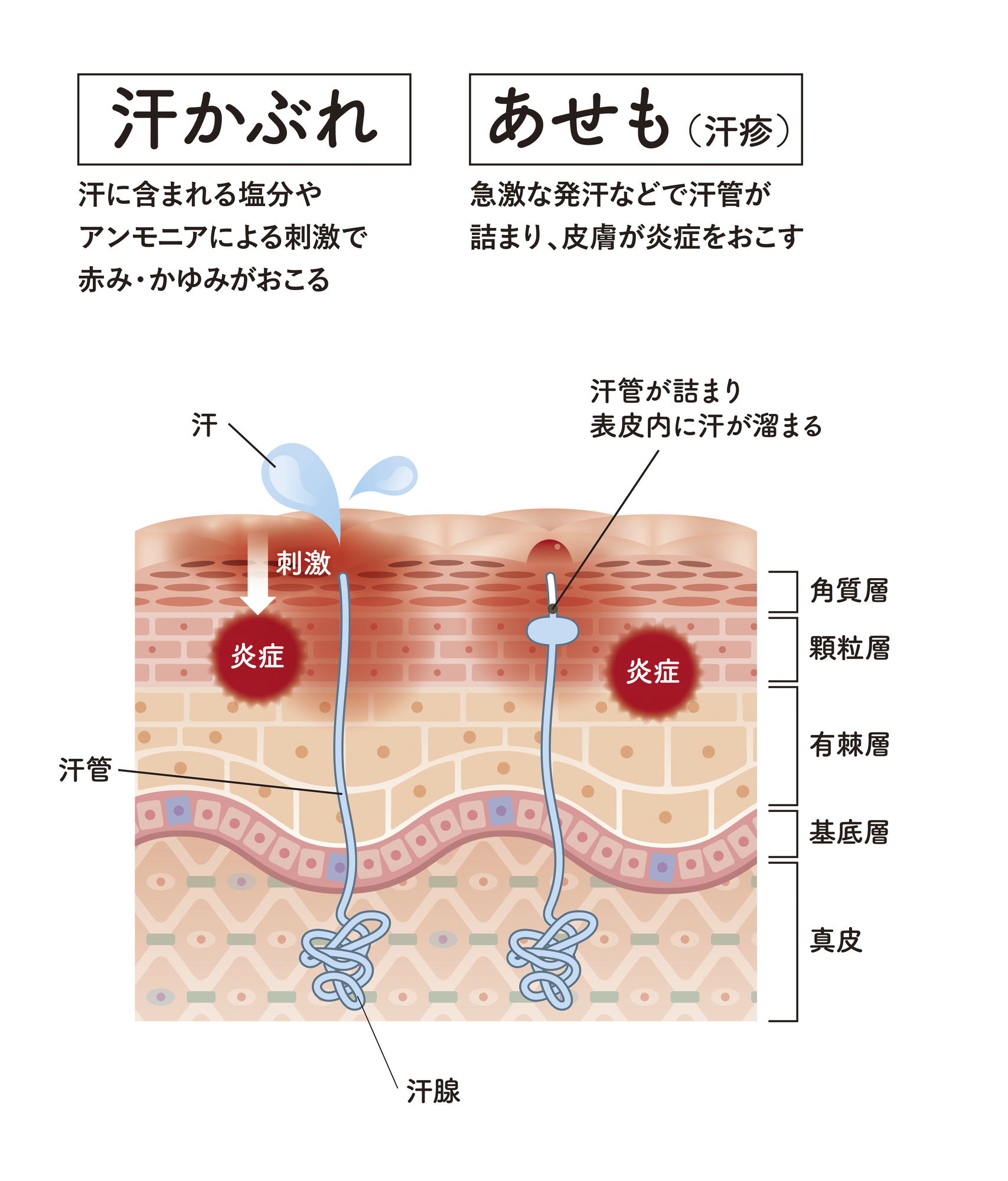 7. 赤みの原因：炎症や紫外線など